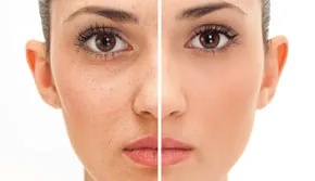 Retouching