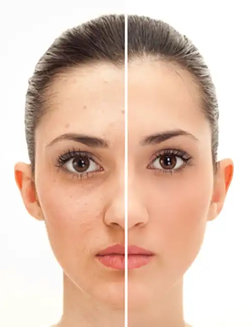 Professional preparation before an unretouched passport photograph